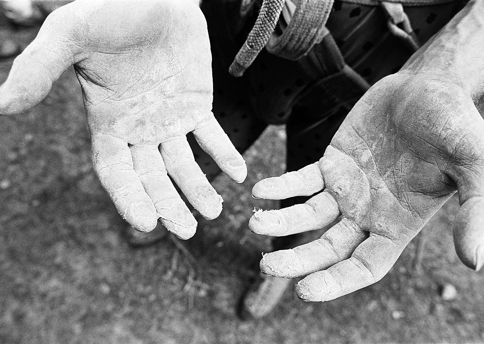 Geschundene Hände eines Kletterers mit teils aufgerissener Haut